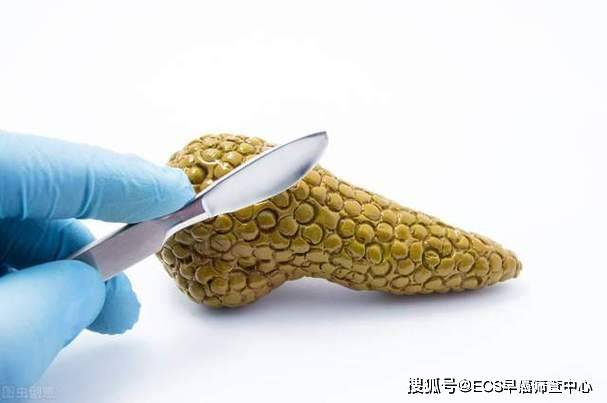 胰腺肿瘤最新研究与探索，小巷深处的特色小店揭示其奥秘