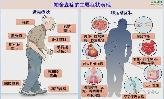 帕金森病治疗最新进展，希望之光照亮未来，自信的力量引领变革